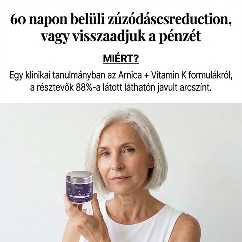 🎉🎁 Gratulálunk! Hihetetlen különleges akció vár rád! Most 50% kedvezménnyel szerezheted meg – olyan elképesztő áron, hogy még mi is alig hisszük el!