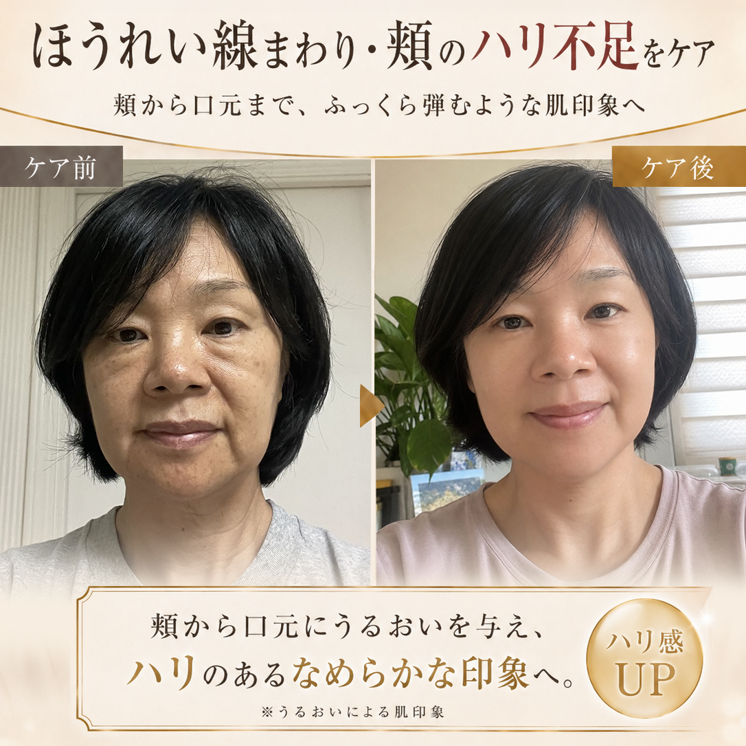 Hiskin® エイジングケア7 マルチエリア マイクロニードルパッチ｜7種の美容成分配合