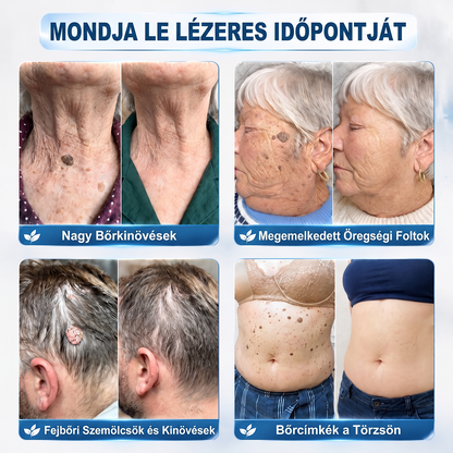 Gratulálunk! 🎉🎉Hihetetlen különleges akció vár rád! Most 50% kedvezménnyel szerezheted meg – olyan elképesztő áron, hogy még mi is alig hisszük el!