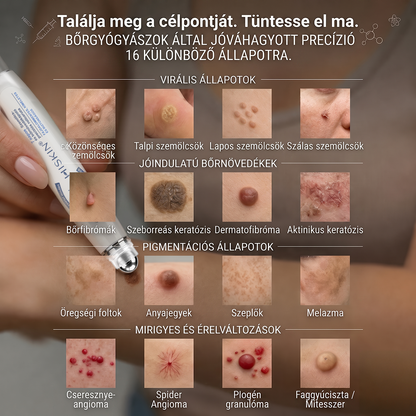 Gratulálunk! 🎉🎉Hihetetlen különleges akció vár rád! Most 50% kedvezménnyel szerezheted meg – olyan elképesztő áron, hogy még mi is alig hisszük el!